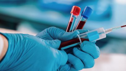 hands of a doctor taking samples of blood